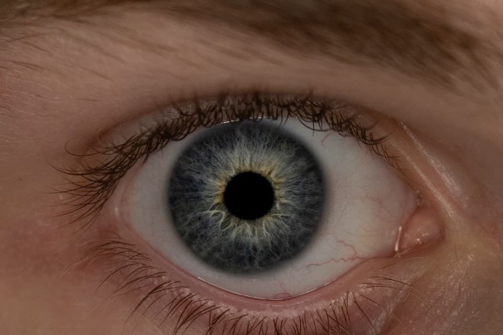 Clinical close-up of Branson's healthy eye used as reference for the custom iris order